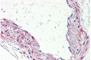 Anti-5HT1B Receptor antibody  ABIN1048254 IHC staining of human vessel. (5HT1B Receptor 抗体  (Internal Region))