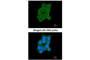 ICC/IF Image Immunofluorescence analysis of paraformaldehyde-fixed A431, using Cartilage-associated protein, antibody at 1:200 dilution. (CRTAP 抗体)