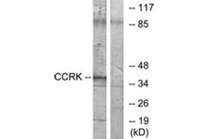 Western Blotting (WB) image for anti-Cyclin-Dependent Kinase 20 (CDK20) (AA 31-80) antibody (ABIN2889669) (CCRK 抗体  (AA 31-80))