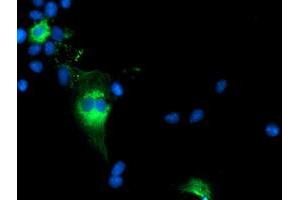 Anti-TCP11L2 mouse monoclonal antibody (ABIN2453719) immunofluorescent staining of COS7 cells transiently transfected by pCMV6-ENTRY TCP11L2 (RC207129). (TCP11L2 抗体)