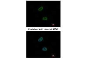 ICC/IF Image Immunofluorescence analysis of paraformaldehyde-fixed HeLa, using C20orf11, antibody at 1:1000 dilution. (GID8/C20orf11 抗体  (Center))