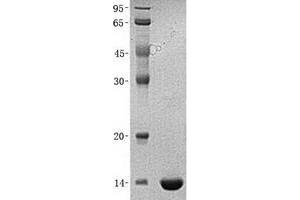 Western Blotting (WB) image for Platelet Derived Growth Factor Subunit B (PDGFB) (Transcript Variant 1) protein (His tag) (ABIN2728538)