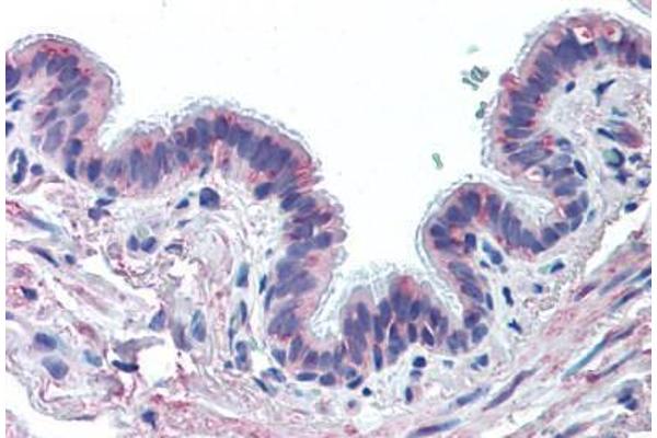 MUC13 抗体  (Extracellular Domain)