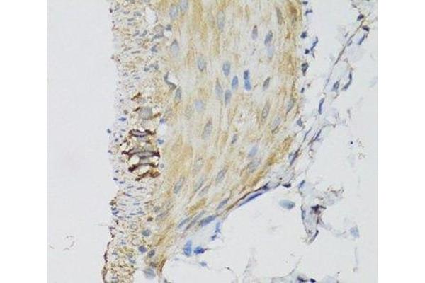 Deoxyguanosine Kinase 抗体