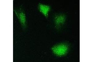 IF analysis of PPCS using anti-PPCS antibody (ABIN6719631).