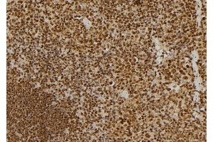 ABIN6275314 at 1/100 staining Mouse spleen tissue by IHC-P. (NUMA1 抗体  (N-Term))