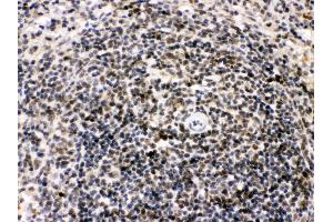 Immunohistochemistry (Paraffin-embedded Sections) (IHC (p)) image for anti-BCL2-Interacting Killer (Apoptosis-Inducing) (BIK) (AA 1-123) antibody (ABIN3043509) (BIK 抗体  (AA 1-123))