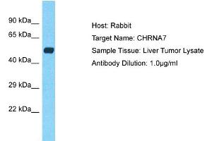 Host: Rabbit Target Name: CHRNA7 Sample Type: Liver Tumor lysates Antibody Dilution: 1. (CHRNA7 抗体  (C-Term))