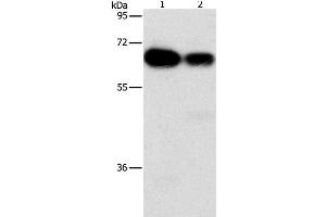 Western Blot analysis of Hela and K562 cell using ARHGEF5 Polyclonal Antibody at dilution of 1:1150 (ARHGEF5 抗体)