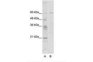 Image no. 1 for anti-Zinc Finger Protein 192 (ZNF192) (N-Term) antibody (ABIN6736101) (ZNF192 抗体  (N-Term))