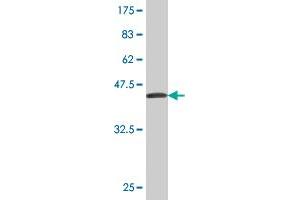 Western Blot detection against Immunogen (37. (CES2 抗体  (AA 514-621))