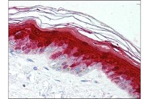 Immunohistochemistry (IHC) image for anti-S100 Calcium Binding Protein A7 (S100A7) antibody (ABIN400722) (S100A7 抗体)