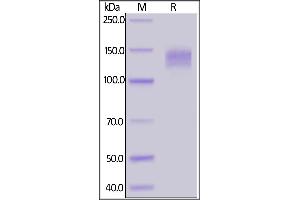 Rabbit LDL R, Fc Tag on  under reducing (R) condition.