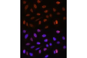 Immunofluorescence (IF) image for anti-Cleavage Stimulation Factor, 3' Pre-RNA, Subunit 2, 64kDa, tau Variant (CSTF2T) (AA 420-560) antibody (ABIN6139164)