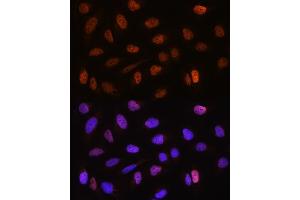 Immunofluorescence analysis of U2OS cells using CSTF2T Rabbit pAb (ABIN6131580, ABIN6139164, ABIN6139165 and ABIN6220675) at dilution of 1:100. (CSTF2T 抗体  (AA 420-560))