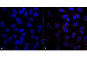 Immunocytochemistry/Immunofluorescence analysis using Mouse Anti-VPS35 Monoclonal Antibody, Clone 5A9 (ABIN6932932). (VPS35 抗体)