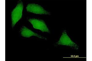 Immunofluorescence of purified MaxPab antibody to IRF3 on HeLa cell. (IRF3 抗体  (AA 1-427))