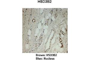 Sample Type :  Monkey vagina   Primary Antibody Dilution :   1:25   Secondary Antibody:  Anti-rabbit-HRP   Secondary Antibody Dilution:   1:1000   Color/Signal Descriptions:  Brown: HSD3B2 Blue: Nucleus   Gene Name:  HSD3B2   Submitted by:  Jonathan Bertin, Endoceutics Inc. (HSD3B2 抗体  (N-Term))