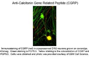 Immunocytochemistry of Anti-Calcitonin Gene Related Peptide (CGRP) (Mouse) Antibody - 200-301-D15 Immunocytochemistry of Anti-Calcitonin Gene Related Peptide (CGRP) (Mouse) Antibody.