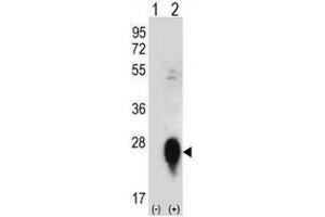 Western blot analysis of CLEC3B (arrow) using rabbit polyclonal CLEC3B Antibody (Center) . (CLEC3B 抗体  (Middle Region))