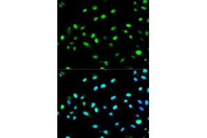Immunofluorescence analysis of MCF7 cell using LETMD1 antibody. (LETMD1 抗体)