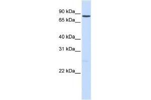 NOTCH1 antibody used at 2. (Notch1 抗体  (Middle Region))