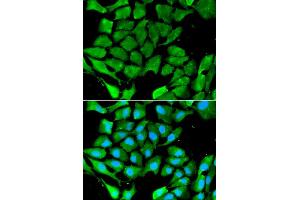 Immunofluorescence analysis of A549 cell using PPARG antibody. (PPARG 抗体)