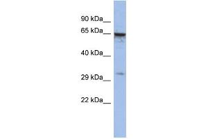 WB Suggested Anti-MAGEA9 Antibody Titration:  0. (MAGEA9 抗体  (Middle Region))