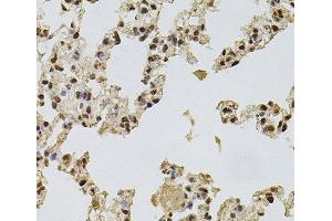 Immunohistochemistry of paraffin-embedded Rat lung using FGF2 Polyclonal Antibody at dilution of 1:100 (40x lens). (FGF2 抗体)