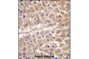 TRIM11 Antibody (C-term) (ABIN657207 and ABIN2846320) immunohistochemistry analysis in formalin fixed and paraffin embedded human heart tissue followed by peroxidase conjugation of the secondary antibody and DAB staining. (TRIM11 抗体  (C-Term))