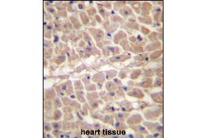 TRIM11 Antibody (C-term) (ABIN657207 and ABIN2846320) immunohistochemistry analysis in formalin fixed and paraffin embedded human heart tissue followed by peroxidase conjugation of the secondary antibody and DAB staining. (TRIM11 抗体  (C-Term))