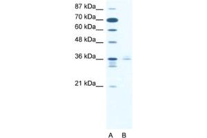 Western Blotting (WB) image for anti-LIM Homeobox 3 (LHX3) antibody (ABIN2460468) (LHX3 抗体)