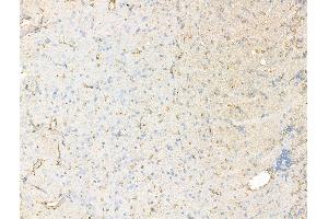 ABIN7094573 and ABIN7098622 at 1/100 staining Rat brain tissue by IHC-P. (Synaptotagmin V 抗体  (Internal Region))