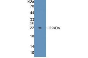 Western blot analysis of recombinant Rat IL1a. (IL1A 抗体  (AA 115-270))