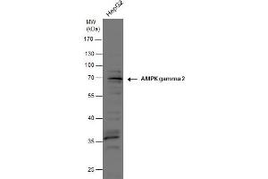 WB Image AMPK gamma 2 antibody detects AMPK gamma 2 protein by western blot analysis. (PRKAG2 抗体  (full length))