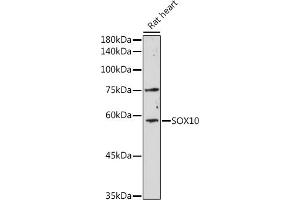 Western blot analysis of extracts of Rat heart, using SOX10 antibody (ABIN6134484, ABIN6148289 and ABIN7101829) at 1:1000 dilution. (SOX10 抗体)