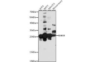 Western blot analysis of extracts of various cell lines, using R antibody (ABIN7269808) at 1:1000 dilution. (RAB38 抗体  (AA 92-211))