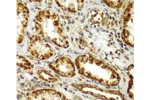 Immunohistochemistry of paraffin-embedded Human kidney using SMAD9 Polyclonal Antibody at dilution of 1:100 (40x lens). (SMAD9 抗体)
