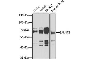 Western blot analysis of extracts of various cell lines, using G antibody (ABIN6133219, ABIN6140940, ABIN6140941 and ABIN6222644) at 1:1000 dilution. (GALNT2 抗体  (AA 442-571))