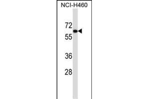 UGT2B11 Antibody (C-term) (ABIN657441 and ABIN2846471) western blot analysis in NCI- cell line lysates (35 μg/lane). (UGT2B11 抗体  (C-Term))