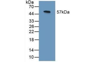 Detection of Recombinant SHC3, Human using Polyclonal Antibody to SHC-Transforming Protein 3 (SHC3) (SHC3 抗体  (AA 188-433))
