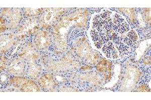Detection of FTH in Human Kidney Tissue using Monoclonal Antibody to Ferritin, Heavy Polypeptide (FTH) (FTH1 抗体  (AA 1-183))