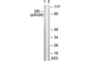 Western blot analysis of extracts from Jurkat cells treated with EGF 200ng/ml 15', using GR (Phospho-Ser226) Antibody. (GR (AA 201-250), (pSer226) 抗体)