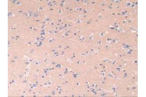 IHC-P analysis of Human Brain Tissue, with DAB staining. (POR 抗体  (AA 77-518))