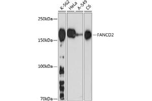 Western blot analysis of extracts of various cell lines, using F antibody (ABIN7267126) at 1:1000 dilution. (FANCD2 抗体)