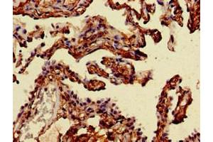Immunohistochemistry (IHC) image for anti-Mannosidase, Alpha, Class 2A, Member 1 (MAN2A1) (AA 31-181) antibody (ABIN7143899)