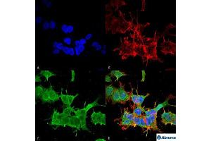 Immunocytochemical staining of SK-N-BE with SPTBN4 monoclonal antibody, clone S393-2 . (SPTBN4 抗体  (AA 1621-18832))