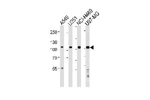 Western blot analysis of lysates from A549,,NCI-,U87-MG cell line (from left to right),using ZNF41 Antibody (N-term) (ABIN1538965 and ABIN2849171). (ZNF41 抗体  (N-Term))