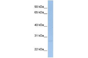 WB Suggested Anti-SIGIRR Antibody Titration:  0. (SIGIRR 抗体  (C-Term))