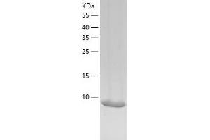 CARD18 Protein (AA 1-90) (His tag)